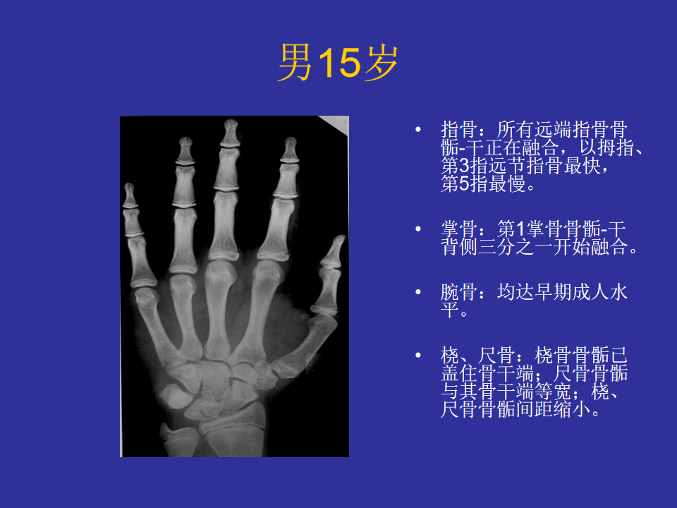 男性骨龄读片指南