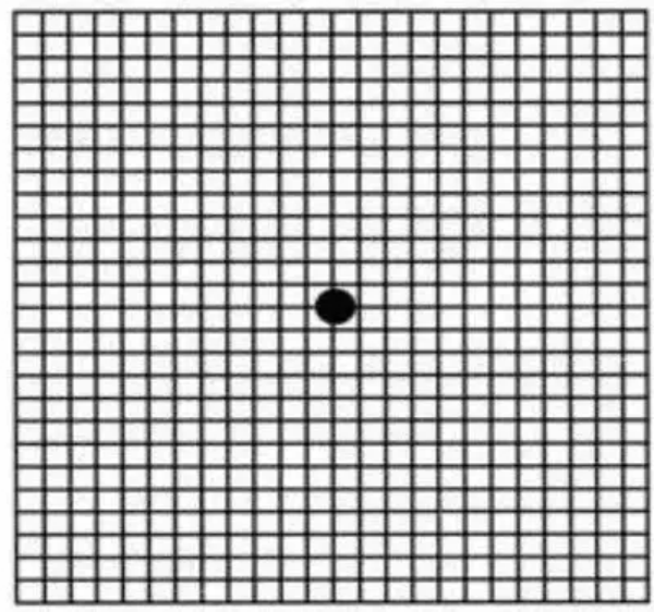 黄斑图测试图片