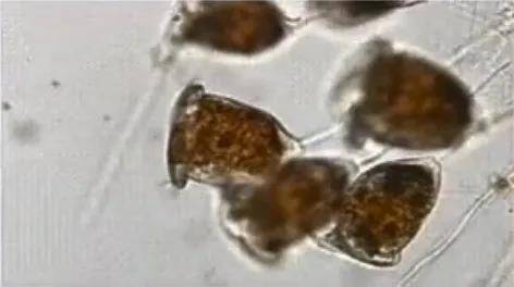 活性污泥生物相观察的经验总结