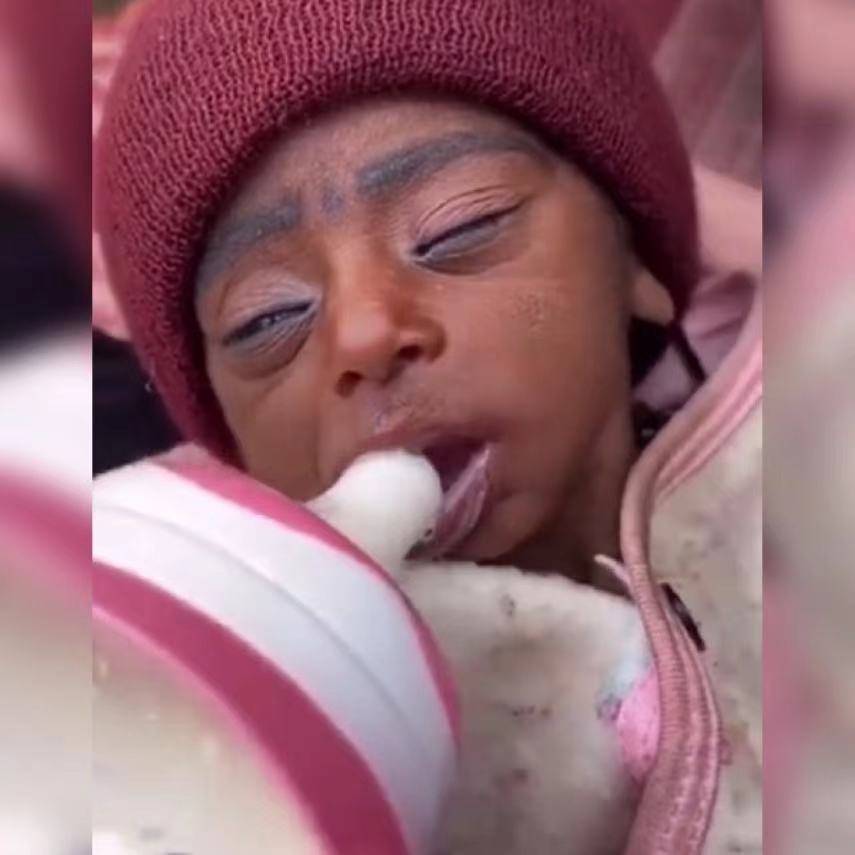 早衰症宝宝喝奶的过程令人揪心不已网友希望可以健康成长