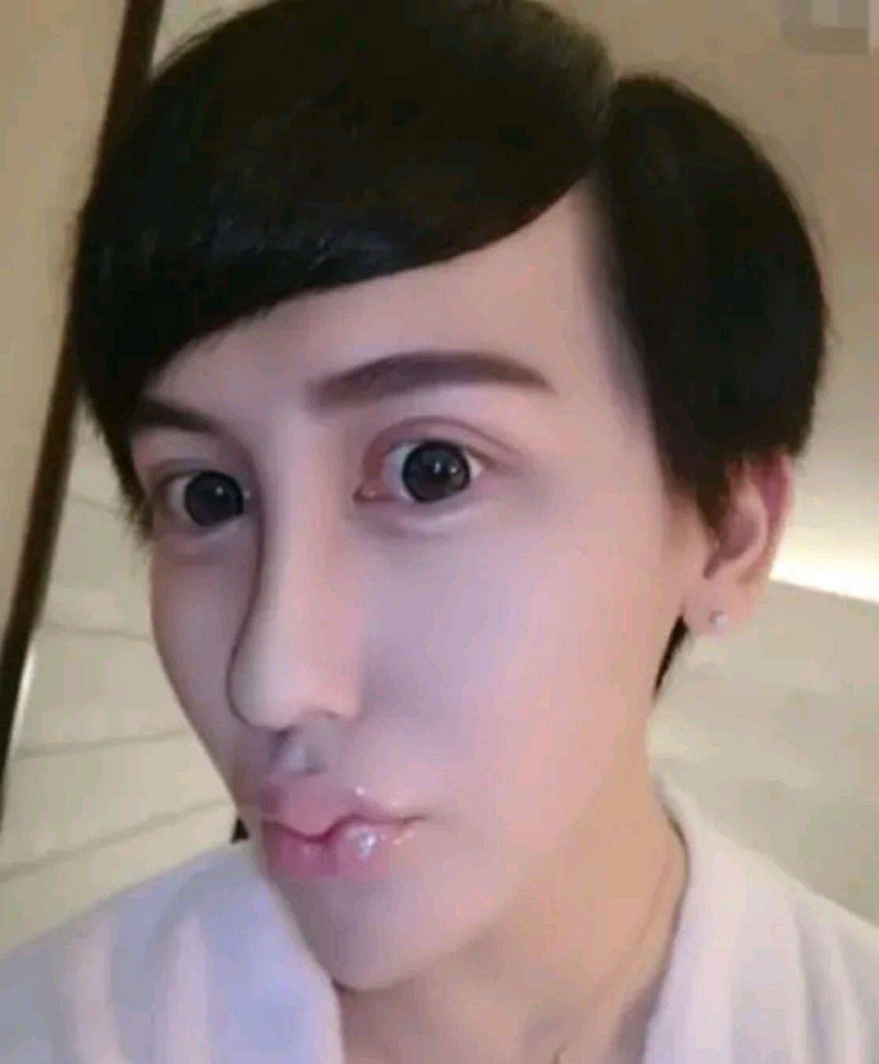 蛇精脸刘梓晨发文透露自己在国外感染新冠并哭诉自己好无助