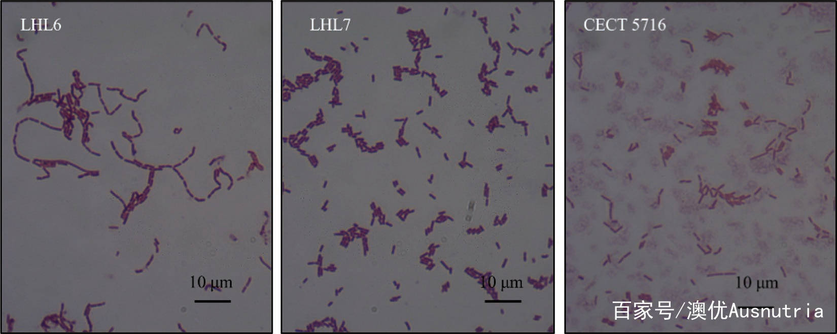 乳酸杆菌显微镜下形态图片