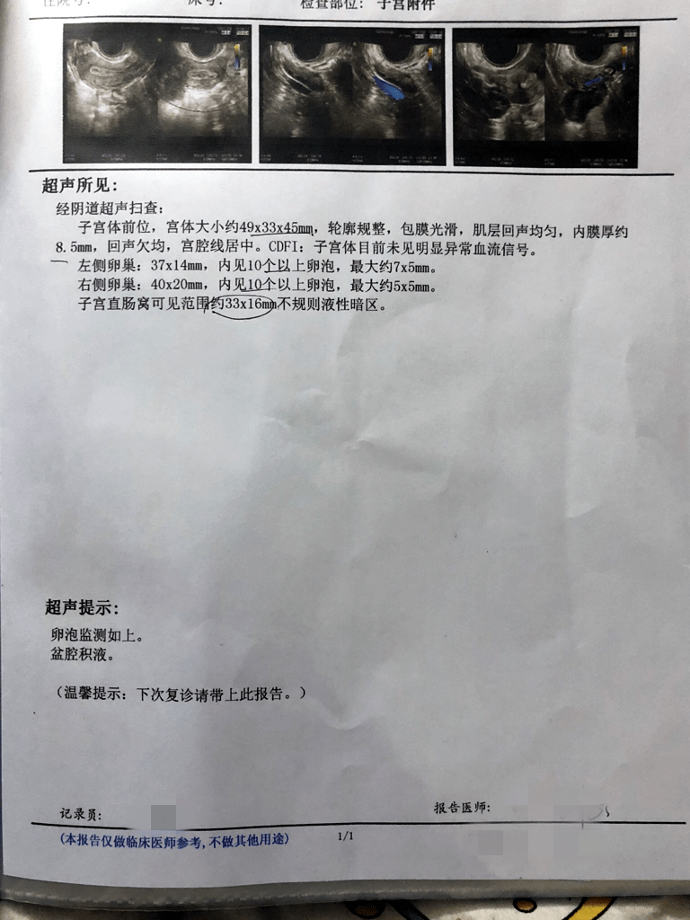 中药怎么调理多囊 33b6eaa243cc41a8902403f9a6c20b4d.png