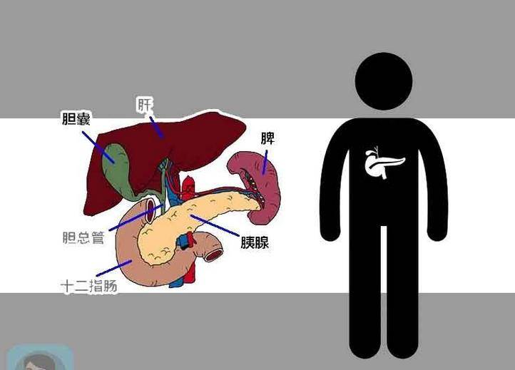 高脂血症胰腺炎临床诊断及治疗
