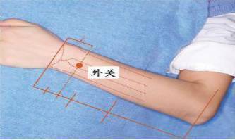 腕管综合征(鼠标手)的针灸治疗方法