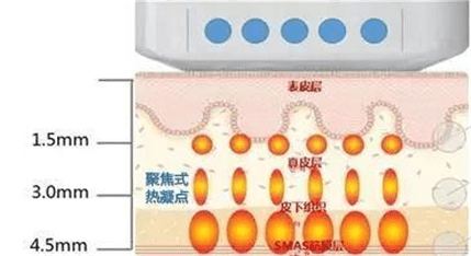 隆鼻后吃了辣椒怎么办