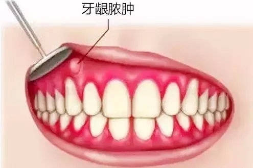 fb3509b1f0324ae6bb00db97ff716a8c.jpeg