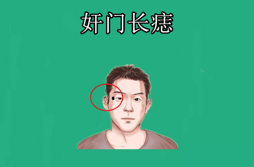 身体5颗黄金痣,藏而不露,价值千金,一个生财,一个升官!