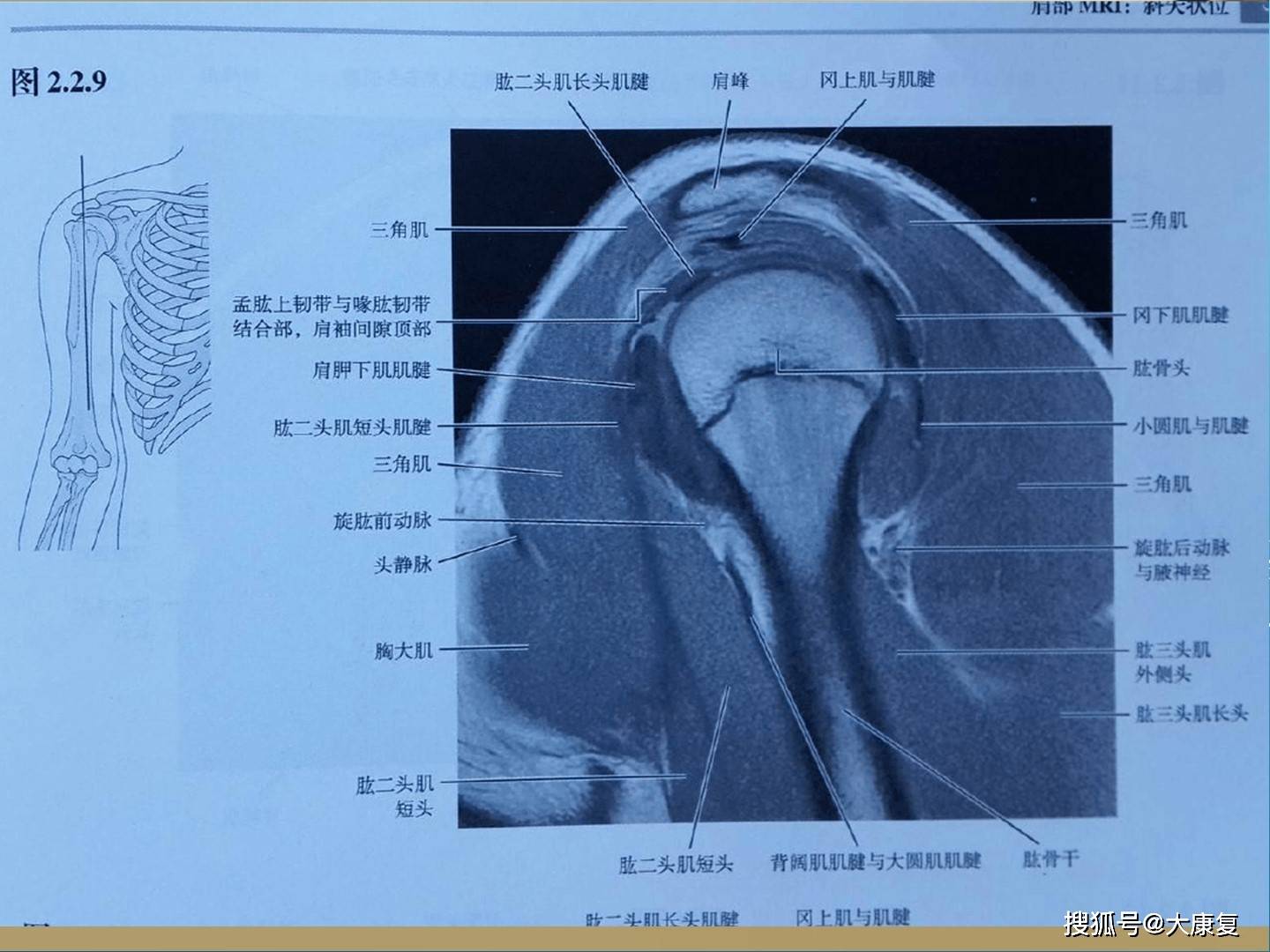 肩關節解剖及常用查體方法