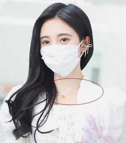 脖子太粗是因为什么 084889a70b7a491ba96beace5b9cf6d6.jpeg