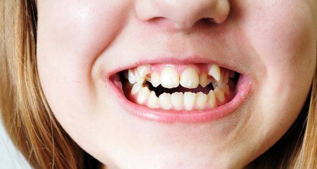 白天梦见被别人打把牙齿打掉了,解析梦境背后的深层含义 白天梦见被别人打把牙齿打掉了,解析梦境背后的深层含义