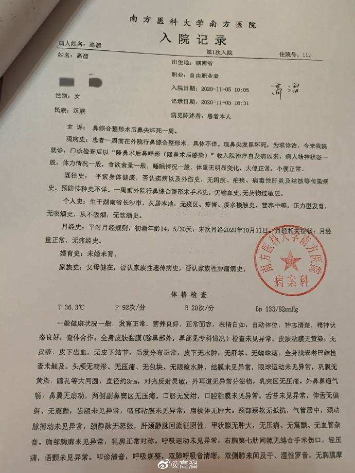 演员高溜自爆整容失败不仅失去工作还面临高额赔偿