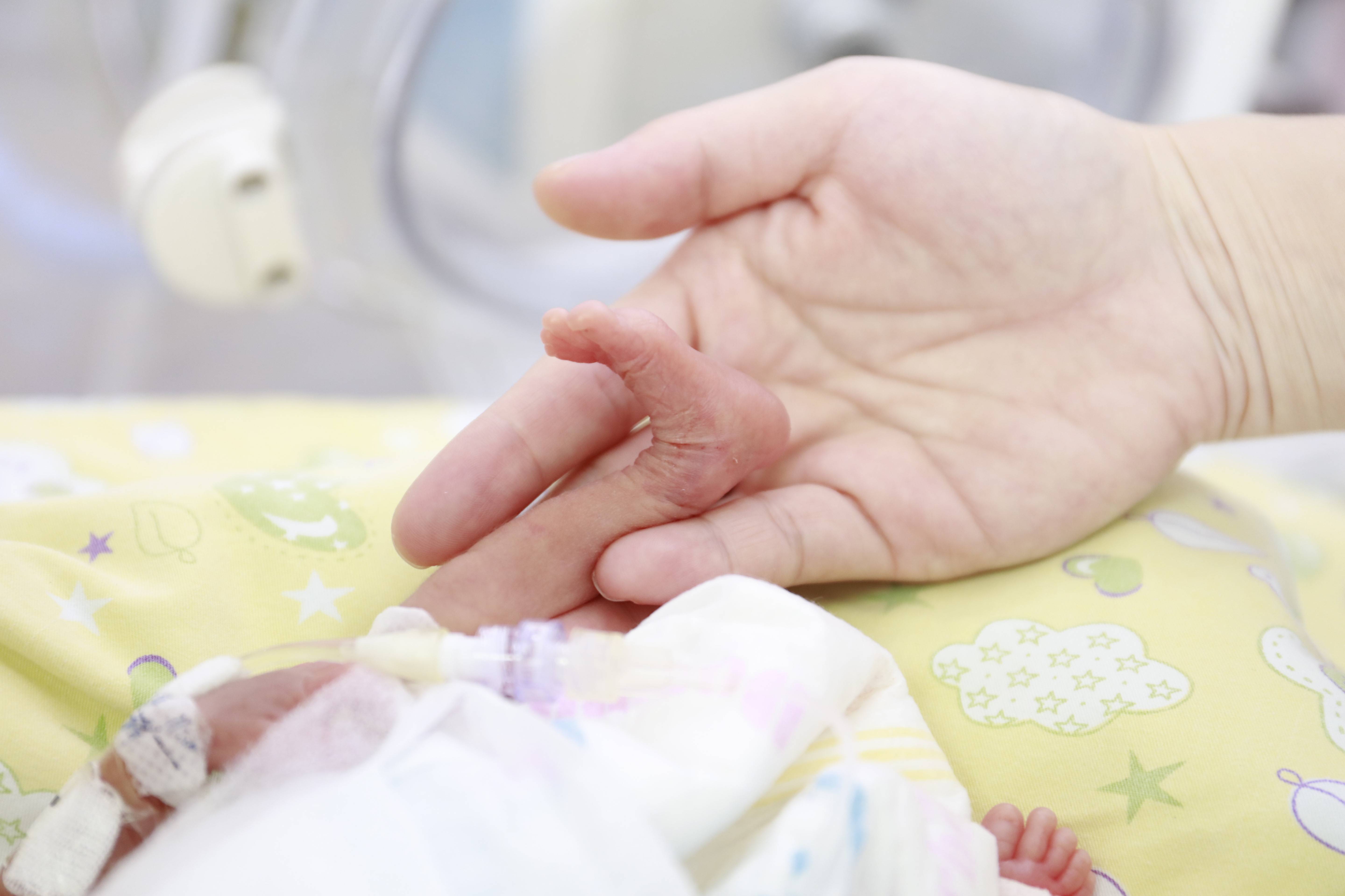 「巴掌宝宝」救治成功！385克、胎龄24周超早产儿平安出院_医学界-助力医生临床决策和职业成长