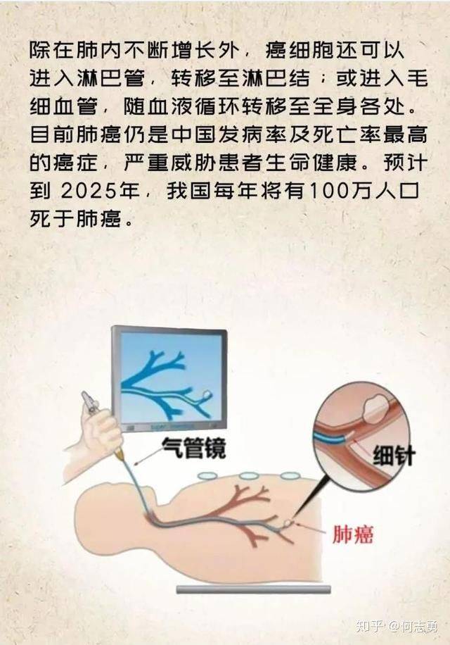 4b7601fe7f3f492483e384e706f311b0.jpeg