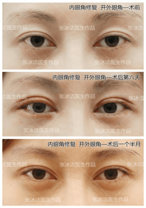 什么样算是大眼睛 6f2e663bfa53431e94a3a3262abf82ae.png