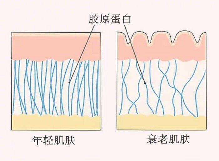随着年龄的增长,我们体内的胶原蛋白会流失的越来越快,现在的00后都