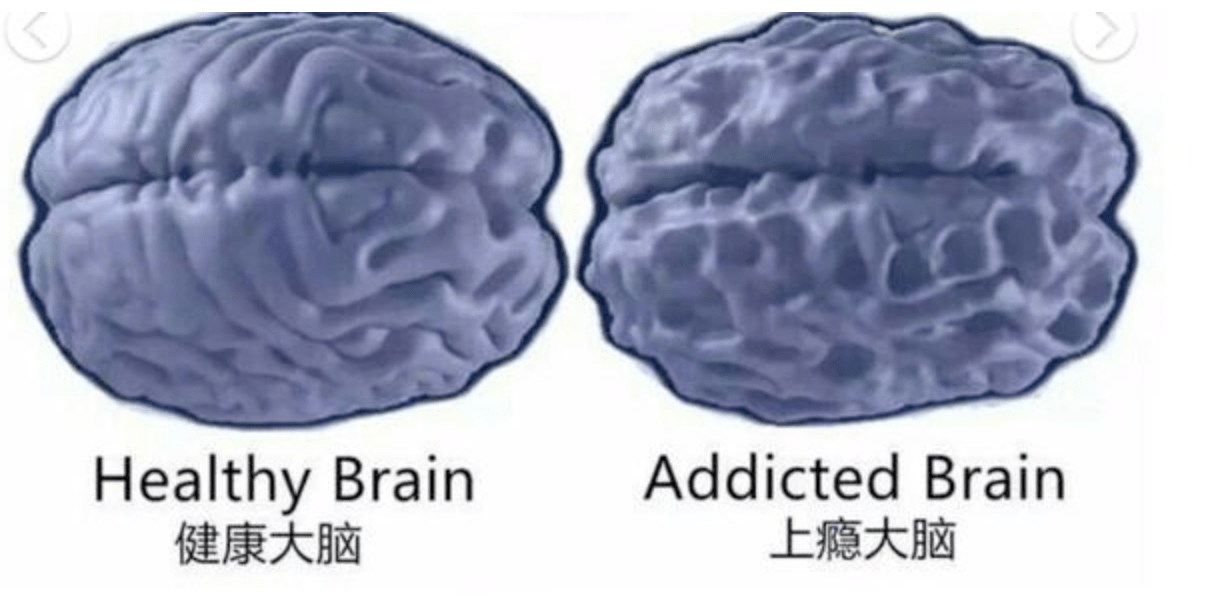 原創手機是怎樣讓孩子大腦越來越笨的3張手繪對比圖反差觸目驚心