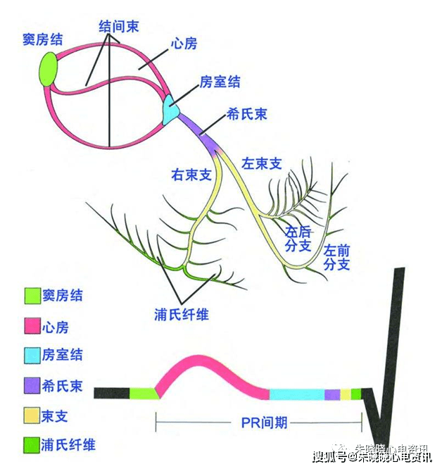 通过任何束支的传导阻滞（右或左）。我们先来了解一下室内的传导结构。