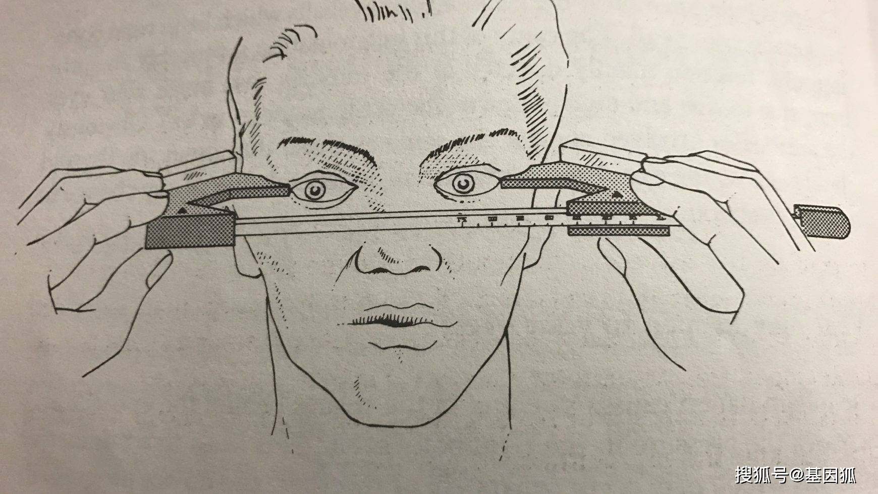 我国科学家在甲亢突眼疾病早期诊断上获突破性进展