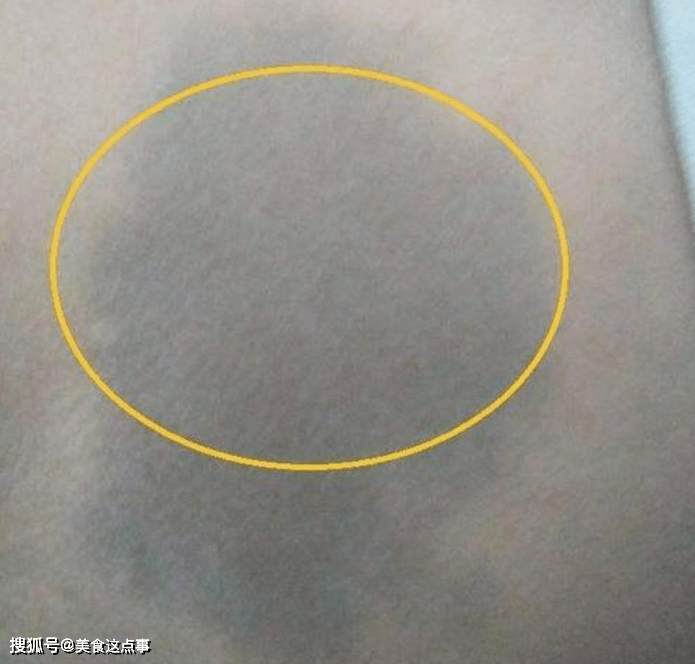 新生儿屁股淤青是怎么回事不是投胎时被踢与父母有关系