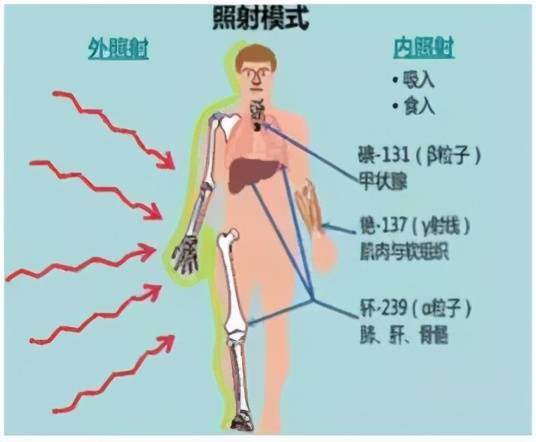 放疗包括外照射和内照射两种.