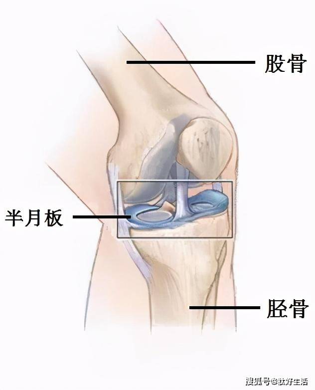 半月板损伤相关知识 帮助了解半月板损伤症状 原因和危害 膝关节