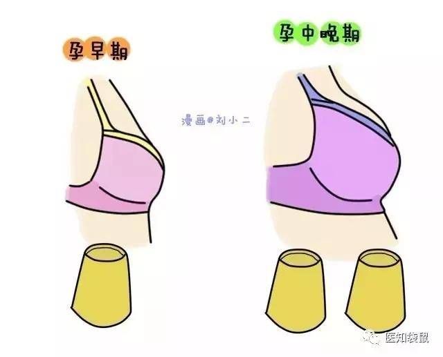 产后乳房下垂是母乳喂养惹的祸