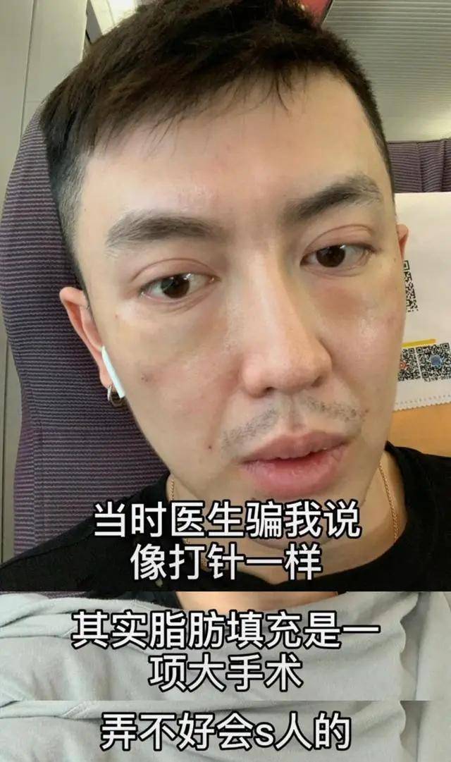 整容失败男生图片