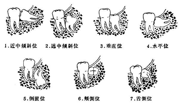 95fe7800f2dc491293f21315f672591b.png