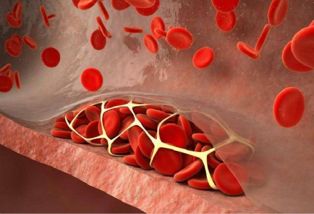 原创血管通畅的人有4个好习惯促进血管垃圾排出预防血管堵塞