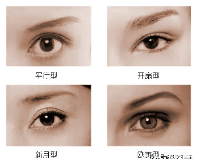 割双眼皮前,切忌6个常见误区,专家告诉你最靠谱的
