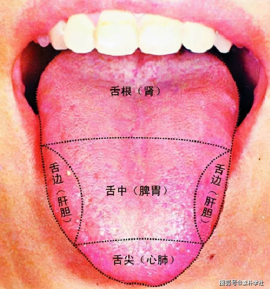 肝火旺舌头图片 胃癌早期舌头裂纹图片