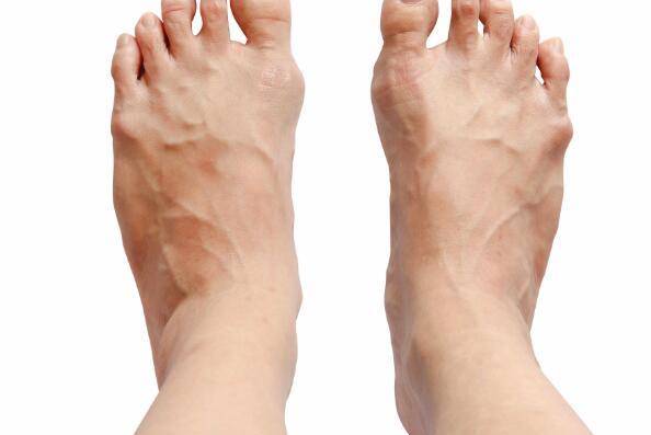 血管堵不堵,脚知道!学会一个动作自行检测,保护血管做好4件事