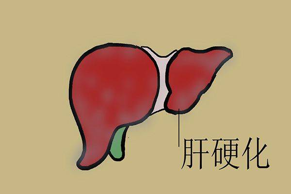 怎么才能知道自己有没有脂肪肝 5b613fef3c4049faa6783d514353762d.jpeg