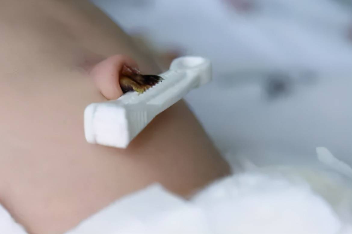 新生儿出生后,抓住剪脐带的剪子"复仇",就是它剪断我脐带的!