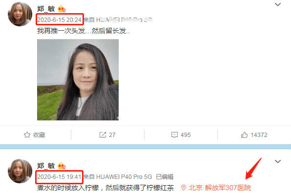 原创岳云鹏妻子郑敏剃光头发发微博称需要做个小手术