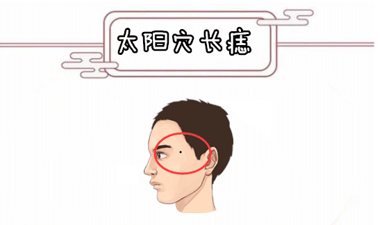 身体5颗暗财痣藏财纳福横财横贵人贵越隐蔽越好