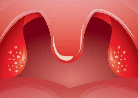 扁桃体分泌物图片
