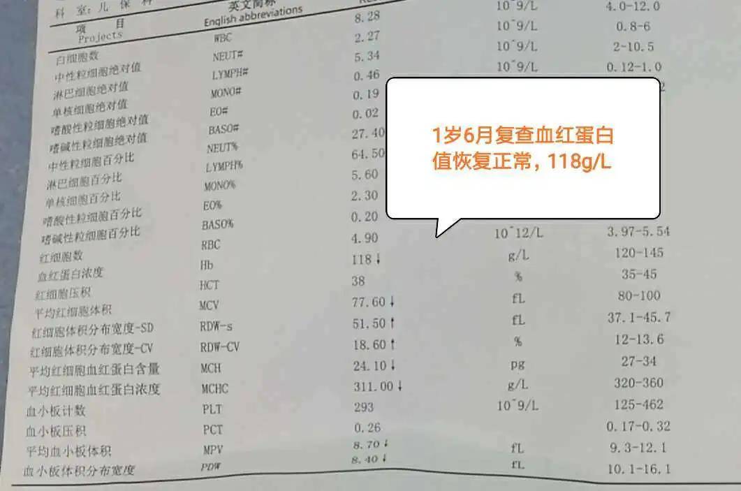 小兒推拿調治缺鐵性貧血的方法