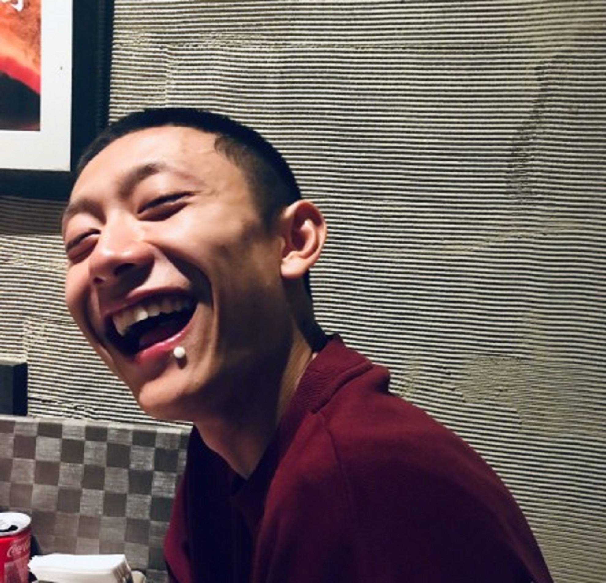 原创张一山与关晓彤打篮球摔伤仍坚持将戏拍完调侃自己年龄大了