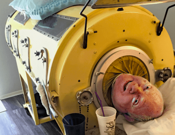 铁肺人保罗:被困"铁桶"69年,一生无法呼吸,停电就意味着死亡