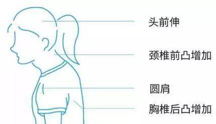 怎么拥有好的体态 bf9a59381dbe4fddbaa36a44a52e7c72.jpeg