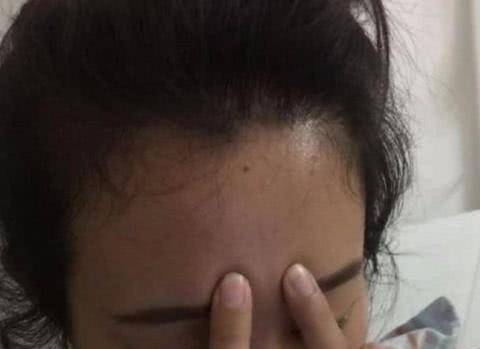 什么方法止鼻涕 e9b08f80e76a4caead0f01f406cd99e3.jpeg