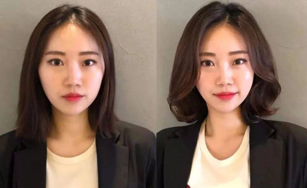 出去人家把我当怪物看 女子整容失败大哭 还患上更严重的病 杨女士