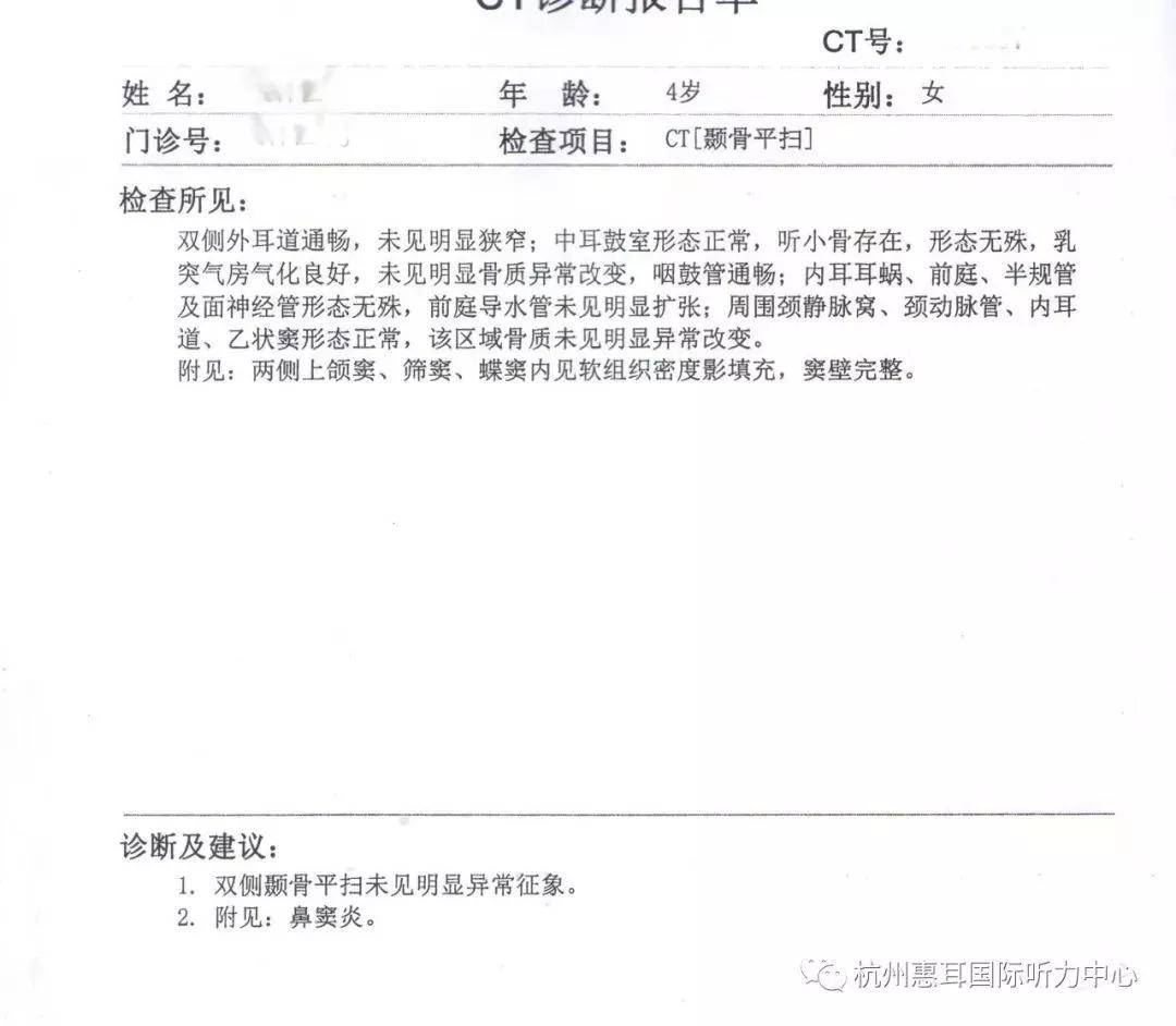 但是基本在医院检查听力报告如