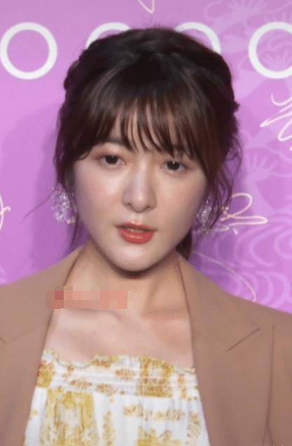 24岁徐娇近照太显老面部肿胀十分僵硬网友吐槽像大妈