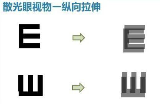 近視通常伴隨著散光什麼是散光如何預防與糾正散光