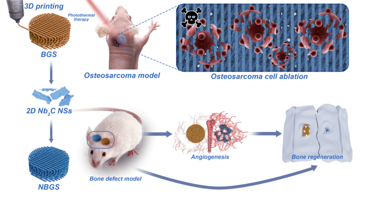 骨肿瘤疗修的生物玻璃支架材料 3d打印超薄二维碳化铌mxene纳米片 图像