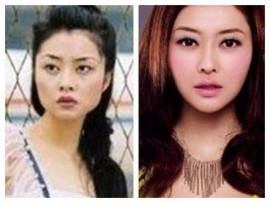 整容最成功 的女明星 多年不火 动过很多刀子却毫无痕迹 电视剧