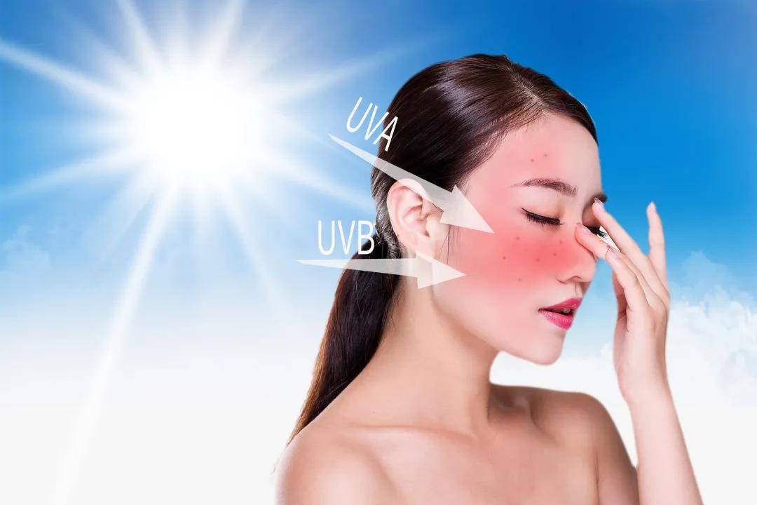 护肤 | 出游晒黑晒伤,你需要的晒后修复攻略来了!_皮肤